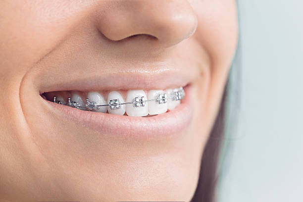 Best Traditional Braces  in Atkinson, IL